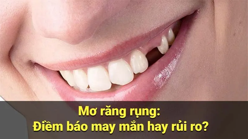 Mơ răng rụng: Điềm báo may mắn hay rủi ro?